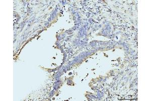 IHC analysis of RPL23 using anti-RPL23 antibody (ABIN7599808). (RPL23 抗体  (AA 12-136))