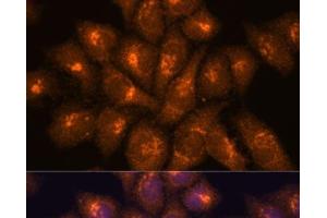 Immunofluorescence analysis of HeLa cells using B3GNT4 Polyclonal Antibody at dilution of 1:100. (B3GNT4 抗体)