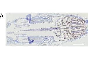 Immunohistochemistry analysis of the expression of the mu and alpha class GSTs. (GSTM1 抗体  (AA 1-218))