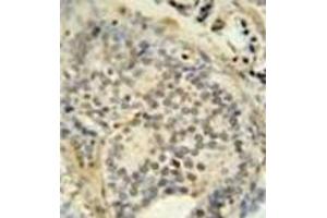 Immunohistochemistry (Paraffin-embedded Sections) (IHC (p)) image for anti-Fused in Sarcoma (FUS) (AA 506-534), (C-Term) antibody (ABIN952406)