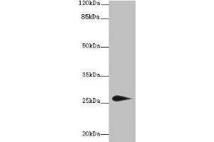 Western blot All lanes: TMEM174 antibody at 0. (TMEM174 抗体  (AA 94-243))