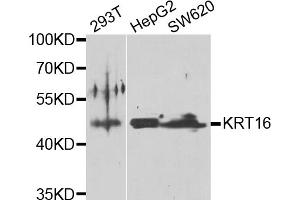Western blot analysis of extracts of various cell lines, using KRT16 antibody (ABIN5975146) at 1/1000 dilution. (KRT16 抗体)