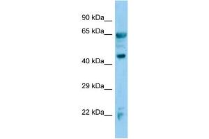 Host:  Rabbit  Target Name:  Adh7  Sample Type:  Mouse Lung lysates  Antibody Dilution:  1. (ADH7 抗体  (C-Term))