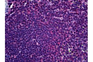 Anti-FADS1 antibody IHC of human spleen. (FADS1 抗体  (AA 1-100))