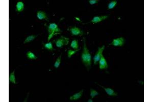 Immunofluorescence staining of U251 cells with ABIN7174328 at 1:166, counter-stained with DAPI. (USP4 抗体  (AA 632-810))