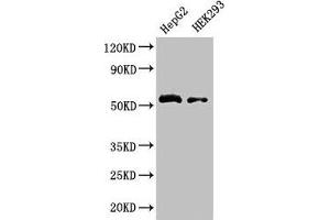 LDHD 抗体  (AA 310-507)
