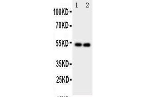 Anti-GABA A Receptor alpha 1 antibody, Western blotting Lane 1: Rat Brain Tissue Lysate Lane 2: Rat Brain Tissue Lysate (GABRA1 抗体  (C-Term))