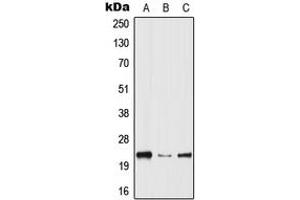 Western Blotting (WB) image for anti-Hematopoietic Prostaglandin D Synthase (HPGDS) (Center) antibody (ABIN7298074)
