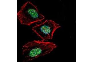 Fluorescent confocal image of HeLa cells stained with XRCC6 antibody.
