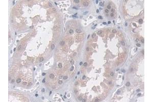 Immunohistochemistry (IHC) image for anti-VAMP (Vesicle-Associated Membrane Protein)-Associated Protein B and C (VAPB) (AA 1-132) antibody (ABIN7443908)
