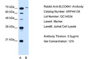WB Suggested Anti-SLCO6A1  Antibody Titration: 5. (SLCO6A1 抗体  (N-Term))