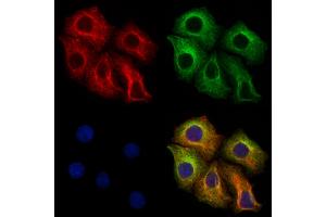 ABIN6265121 and ABIN6273320 staining Hela cells by IF/ICC. (SLC25A46 抗体  (N-Term))