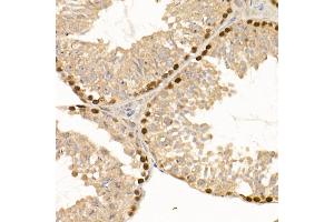 Immunohistochemistry (IHC) image for anti-DNA (Cytosine-5)-Methyltransferase 1 (DNMT1) antibody (ABIN7266808)