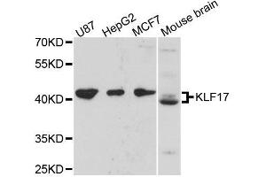 Western blot analysis of extracts of various cell lines, using KLF17 antibody. (KLF17 抗体  (AA 210-389))
