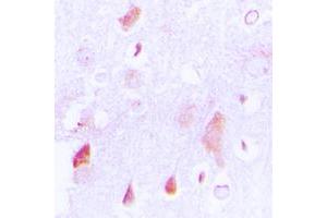 Immunohistochemical analysis of HCCS staining in human brain formalin fixed paraffin embedded tissue section. (HCCS 抗体  (Center))