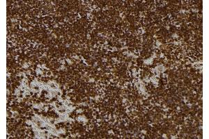 ABIN6273521 at 1/100 staining Mouse spleen tissue by IHC-P. (PMS1 抗体  (Internal Region))