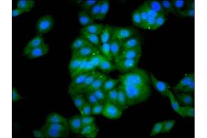 Immunofluorescence staining of HepG2 cells with ABIN7165258 at 1:133, counter-stained with DAPI. (DEPP1 (AA 57-174) 抗体)