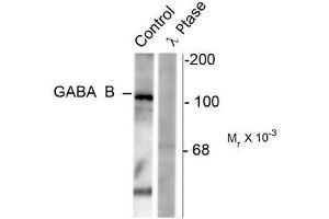 Image no. 1 for anti-gamma-aminobutyric Acid (GABA) B Receptor, 1 (GABBR1) (pSer923) antibody (ABIN372645) (GABBR1 抗体  (pSer923))