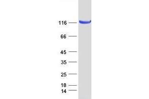 Western Blotting (WB) image for Neurotrophic Tyrosine Kinase, Receptor, Type 2 (NTRK2) (Transcript Variant A) protein (Myc-DYKDDDDK Tag) (ABIN2734332)