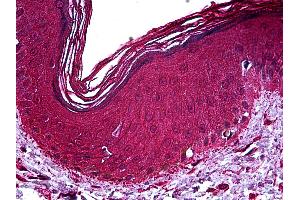 Immunohistochemistry (IHC) image for anti-Nuclear Receptor Subfamily 2, Group C, Member 2 (NR2C2) (AA 43-153) antibody (ABIN626187)
