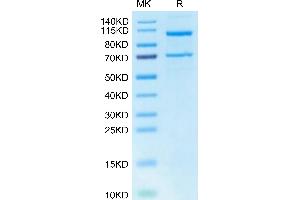 C5 Protein (AA 19-1676) (His tag)