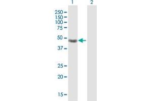 Western Blot analysis of CRELD1 expression in transfected 293T cell line by CRELD1 MaxPab polyclonal antibody.