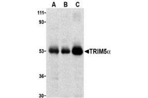 Western blot analysis of TRIM5 alpha expression in human stomach (A), thymus (B), and uterus (C) cell lysate with this product at 2 μg /ml. (TRIM5 抗体  (C-Term, Isoform alpha))