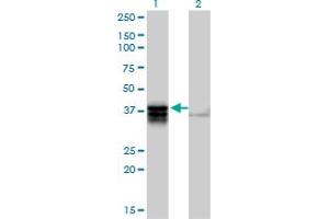 Western Blot analysis of TRDD3 expression in transfected 293T cell line by TRDD3 MaxPab polyclonal antibody. (TRDD3 抗体  (AA 1-296))