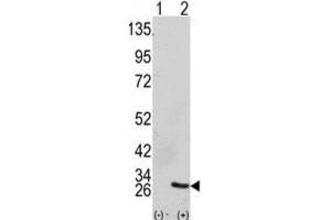Western Blotting (WB) image for anti-Growth Factor Receptor-Bound Protein 2 (GRB2) antibody (ABIN3002593) (GRB2 抗体)