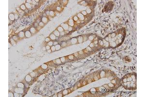 Immunoperoxidase of monoclonal antibody to MAPK13 on formalin-fixed paraffin-embedded human small Intestine. (MAPK13 抗体  (AA 251-365))