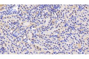 Detection of AGXT2 in Human Kidney Tissue using Polyclonal Antibody to Alanine Glyoxylate Aminotransferase 2 (AGXT2) (AGXT2 抗体  (AA 259-514))