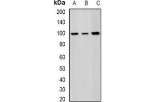 Western blot analysis of SAP145 expression in Hela (A), MCF7 (B), mouse testis (C) whole cell lysates. (SF3B2 抗体)