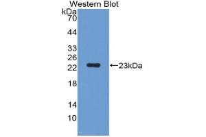 Detection of Recombinant PGLYRP1, Rat using Polyclonal Antibody to Peptidoglycan Recognition Protein 1 (PGLYRP1) (PGLYRP1 抗体  (AA 18-183))