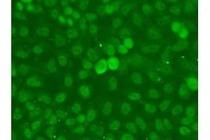 Immunofluorescence analysis of A549 cell using SSNA1 antibody. (SSNA1 抗体)