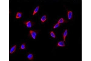 Immunofluorescence (IF) image for anti-SRY (Sex Determining Region Y)-Box 9 (SOX9) (AA 41-70) antibody (ABIN3032745)