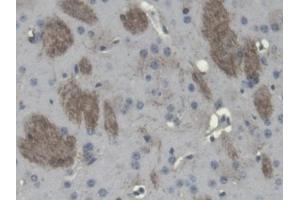 DAB staining on IHC-P; Samples: Mouse Cerebrum Tissue (Cnpase 抗体  (AA 110-365))