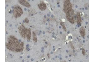 DAB staining on IHC-P; Samples: Mouse Cerebrum Tissue (Cnpase 抗体  (AA 110-365))