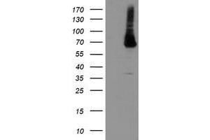 Western Blotting (WB) image for anti-Phosphoglucomutase 3 (PGM3) antibody (ABIN1500177) (Phosphoglucomutase 3 抗体)
