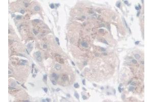 Detection of GAL9 in Human Stomach Tissue using Polyclonal Antibody to Galectin 9 (GAL9) (Galectin 9 抗体  (AA 1-323))