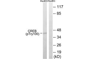 Western blot analysis of extracts from HUVEC cells, treated with etoposide (25uM, 24hours), using CREB (Phospho-Thr100) antibody. (CREB1 抗体  (pThr100))