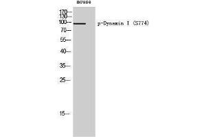 Western Blotting (WB) image for anti-Dynamin 1 (DNM1) (pSer774) antibody (ABIN3182513)