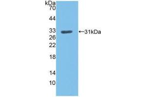Western blot analysis of recombinant Human LDLR. (LDLR 抗体  (AA 497-742))