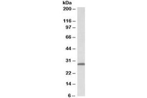 Western blot testing of human skin lysate with 14-3-3 sigma antibody at 0. (14-3-3 sigma/SFN 抗体)