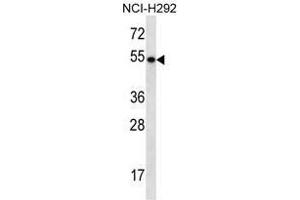 TBC1D3E Antibody (C-term) western blot analysis in NCI-H292 cell line lysates (35µg/lane). (TBC1D3E (AA 497-527), (C-Term) 抗体)