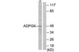 Western blot analysis of extracts from Jurkat cells, using ADPGK Antibody. (ADPGK 抗体  (AA 241-290))