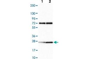 Western blot analysis of Lane 1: Human cell line RT-4 Lane 2: Human cell line U-251MG sp with CLK2 polyclonal antibody  at 1:100-1:250 dilution. (CLK2 抗体)