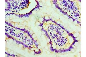 Immunohistochemistry of paraffin-embedded human small intestine tissue using ABIN7170819 at dilution of 1:100 (STIP1 抗体  (AA 1-543))
