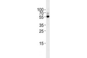 TGF Beta 2 antibody western blot analysis in Raji lysate. (TGFB2 抗体  (AA 277-306))