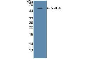 Detection of Recombinant IRF2, Mouse using Polyclonal Antibody to Interferon Regulatory Factor 2 (IRF2) (IRF2 抗体  (AA 1-349))