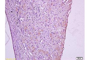 Formalin-fixed and paraffin embedded: rat spinal cord tissue labeled with Anti-Dnmt-3-beta Polyclonal Antibody (ABIN727623), Unconjugated at 1:600, followed by conjugation to the secondary antibody and DAB staining (DNMT3B 抗体  (AA 1-80))